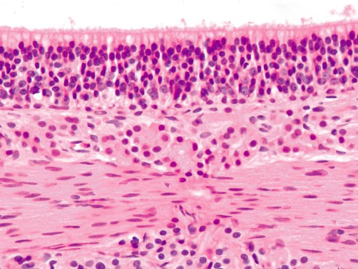 Testis histology slides seminiferous tubule vessels spermatogenesis epithelium pathology